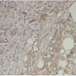 Proteasome Subunit Beta Type 6 (PSMB6) Antibody