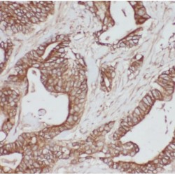 Proteasome Subunit Beta Type 7 (PSMB7) Antibody