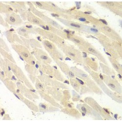 Proteasome Activator Subunit 1 (PSME1) Antibody