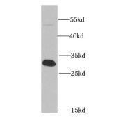 WB analysis of mouse brain tissue, using PSME1 antibody (1/1000 dilution).