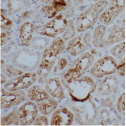 Proteasome Activator Complex Subunit 2 (PSME2) Antibody