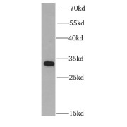 WB analysis of mouse brain tissue, using PSME2 antibody (1/1000 dilution).