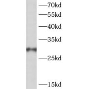 WB analysis of Jurkat cells, using PSMG2 antibody (1/600 dilution).