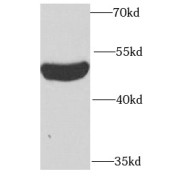 WB analysis of mouse thymus tissue, using PSTPIP1 antibody (1/1000 dilution).