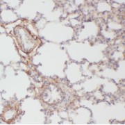 IHC-P analysis of human lung tissue, using PTAFR antibody (1/50 dilution).