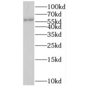 WB analysis of mouse heart tissue, using PTBP2 antibody (1/1000 dilution).