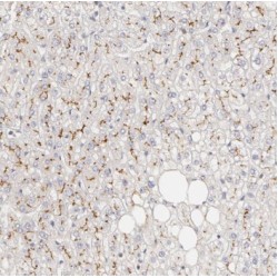 Protein Patched Homolog 1 (PTCH1) Antibody