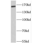 WB analysis of mouse brain tissue, using PTCH1 antibody (1/500 dilution).