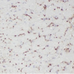 Protein Patched Homolog 2 (PTCH2) Antibody