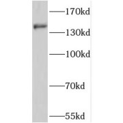 WB analysis of HepG2 cells, using PTCH2 antibody (1/500 dilution).