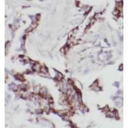 Phosphatidylinositol-3,4,5-Trisphosphate 3-Phosphatase And Dual-Specificity Protein Phosphatase PTEN (PTEN) Antibody