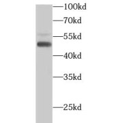 WB analysis of DU 145 cells, using PTEN antibody (1/2000 dilution).