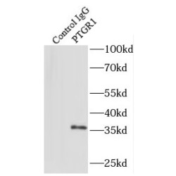 Prostaglandin Reductase 1 (PTGR1) Antibody