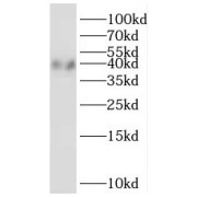 WB analysis of mouse kidney tissue, using PTGR2 antibody (1/500 dilution).