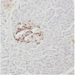 Parathyroid Hormone Receptor 2 (PTH2R) Antibody