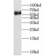 WB analysis of L02 cells, using PTH2R antibody (1/500 dilution).