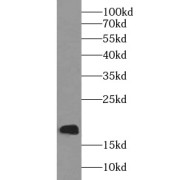 WB analysis of Recombinant protein, using PTH-Specific antibody (1/2000 dilution).