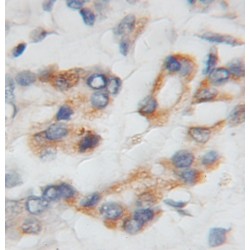 PTP4A1/PRL1 (PTP4A1) Antibody