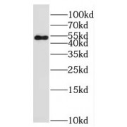 WB analysis of MCF7 cells, using PTP4A1 antibody (1/800 dilution).