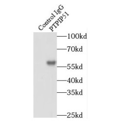 Regulator Of Microtubule Dynamics Protein 3 (RMDN3) Antibody