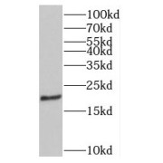 WB analysis of HepG2 cells, using PTPIP51 antibody (1/500 dilution).