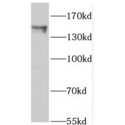 WB analysis of K-562 cells, using PTPN14 antibody (1/400 dilution).