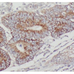 Protein Tyrosine Phosphatase, Non Receptor Type 23 (PTPN23) Antibody