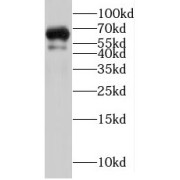 WB analysis of HL-60 cells, using PTPN5 antibody (1/100 dilution).