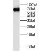 WB analysis of mouse liver tissue, using PTPN9 antibody (1/1000 dilution).