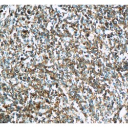 PTPRCAP / CD45AP Antibody