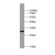 WB analysis of Jurkat cells, using PTPRCAP antibody (1/200 dilution).