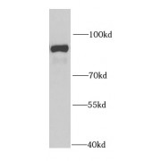 WB analysis of mouse brain tissue, using PTPRE antibody (1/1000 dilution).