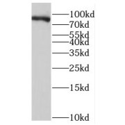 WB analysis of HeLa cells, using rPTPÏ antibody (1/1000 dilution).