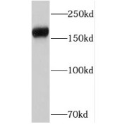 WB analysis of HepG2 cells, using PTPRZ1 antibody (1/500 dilution).