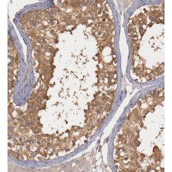 Pituitary Tumor-Transforming Gene 1 Protein-Interacting Protein (PTTG1IP) Antibody