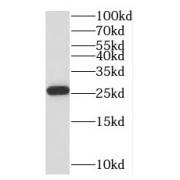 WB analysis of HeLa cells, using PTTG1IP antibody (1/200 dilution).