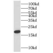 WB analysis of A549 cells, using PUMA antibody (1/500 dilution).