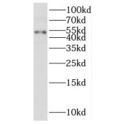 WB analysis of A549 cells, using PUS3 antibody (1/500 dilution).