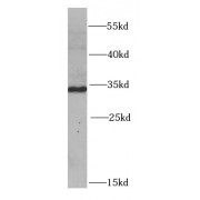 WB analysis of HT-1080 cells, using PYCR1 antibody (1/1000 dilution).