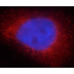 Pyrroline-5-Carboxylate Reductase Family Member 2 (PYCR2) Antibody