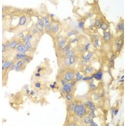 Glycogen Phosphorylase, Brain (PYGB) Antibody