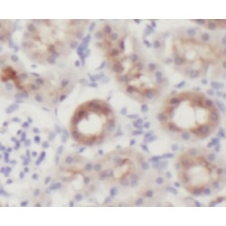 Glycogen Phosphorylase, Liver (PYGL) Antibody