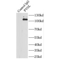 Glycogen Phosphorylase, Liver (PYGL) Antibody