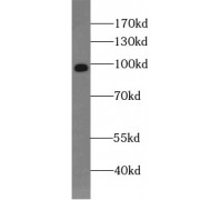WB analysis of HeLa cells, using PYGL antibody (1/1000 dilution).