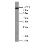 WB analysis of mouse skeletal muscle tissue, using PYGM-Specific antibody (1/1000 dilution).