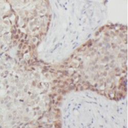 Pygopus Homolog 2 (PYGO2) Antibody