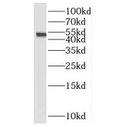 WB analysis of MDA-MB-453s cells, using PYGO2 antibody (1/600 dilution).