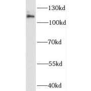 WB analysis of mouse brain tissue, using PTK2B antibody (1/1000 dilution).