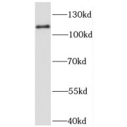 WB analysis of mouse brain tissue, using PTK2B antibody (1/1000 dilution).