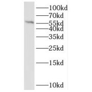 WB analysis of human placenta tissue, using QRSL1 antibody (1/300 dilution).